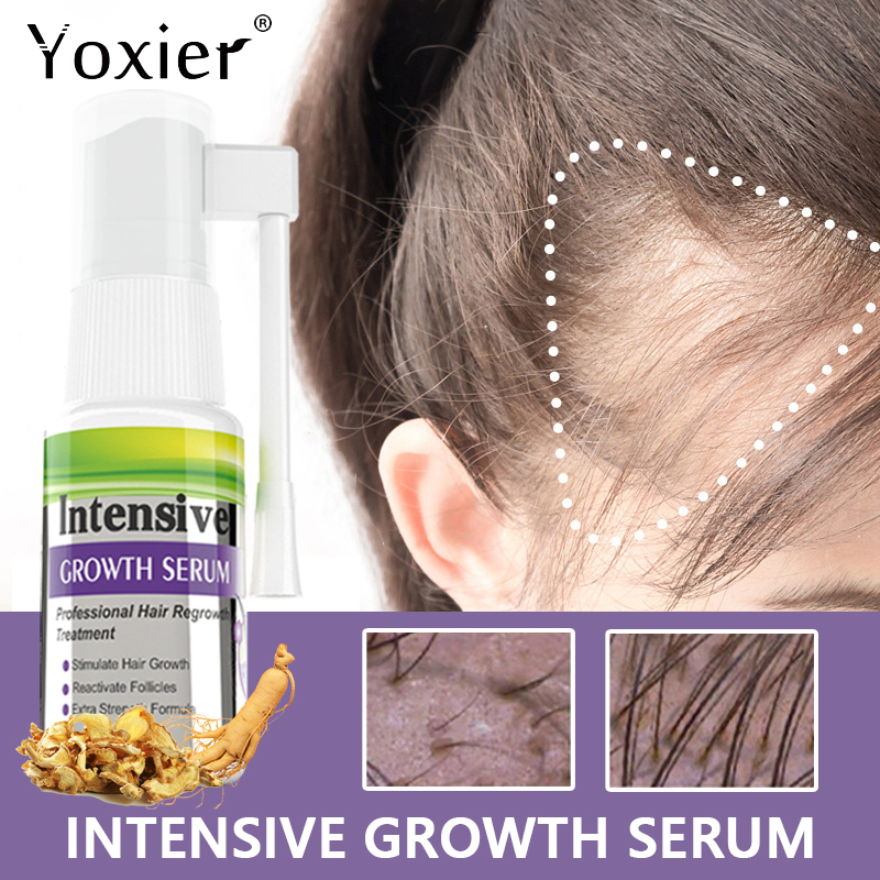 Hair Care Treatment - Intensywne Serum wzrostu zapobiec utrata włosów