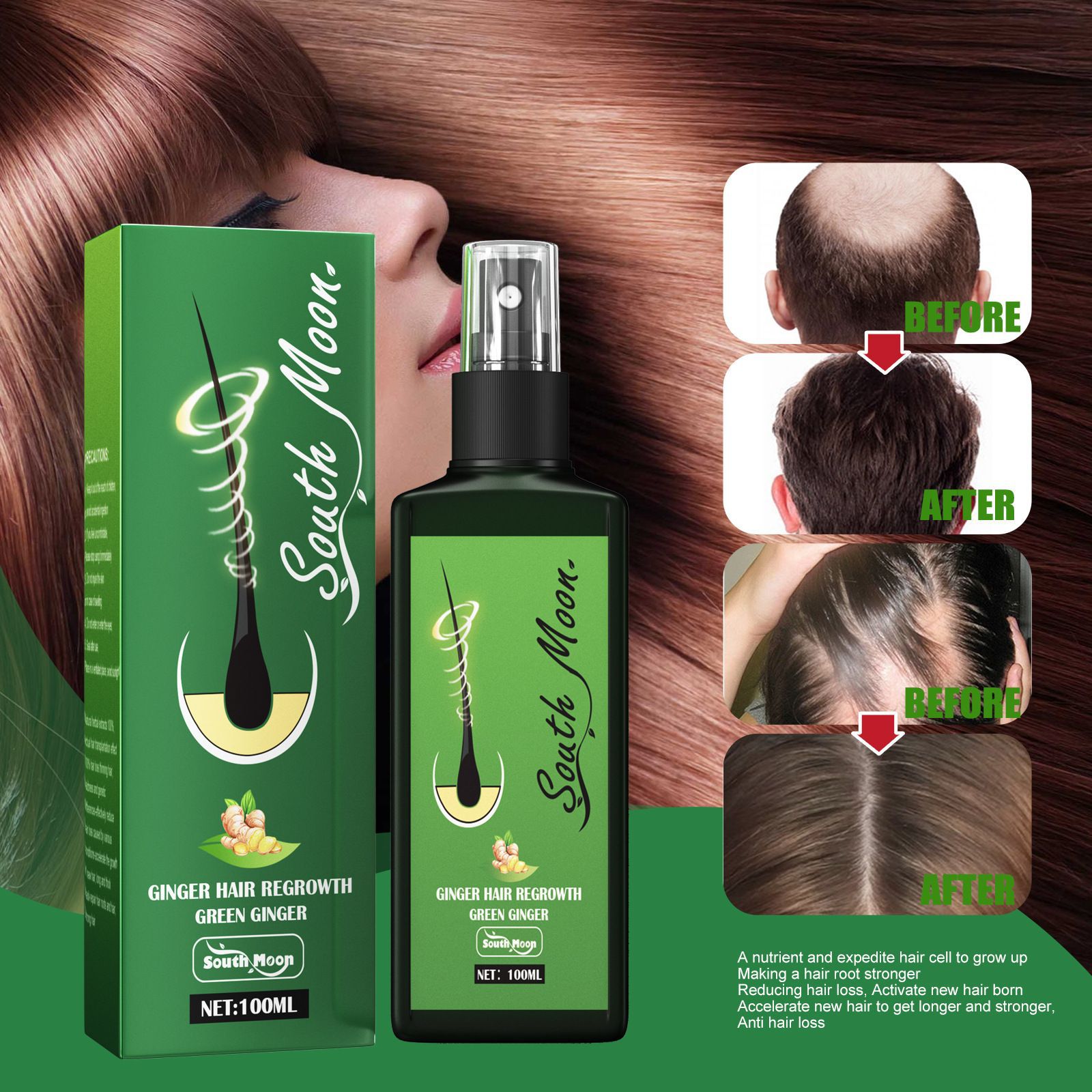 Spray na porost włosów z imbia – Hair Care Elseve recenzja i cena